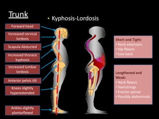 Trunk • Kyphosis-Lordosis
Forward head
Increased cervical
lordosis
Scapula Abducted
Increased thoracic
kyphosis
Increased lumbar
lordosis
Anterior pelvic tilt
Knees slightly
hyperextended
Ankles slightly
plantarflexed
Short and Tight:
• Neck extensors
• Hip flexors
• Low back
Lengthened and
Weak:
• Neck flexors
• Hamstrings
• Erector spinae
• Possibly abdominals
 