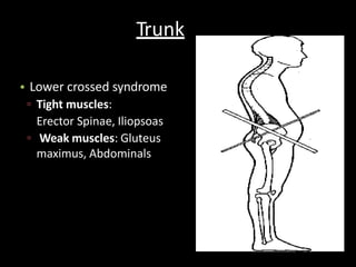 Trunk
• Lower crossed syndrome
▫ Tight muscles:
Erector Spinae, Iliopsoas
▫ Weak muscles: Gluteus
maximus, Abdominals
 