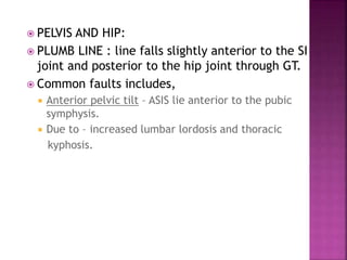  PELVIS AND HIP:
 PLUMB LINE : line falls slightly anterior to the SI
joint and posterior to the hip joint through GT.
 Common faults includes,
 Anterior pelvic tilt – ASIS lie anterior to the pubic
symphysis.
 Due to – increased lumbar lordosis and thoracic
kyphosis.
 
