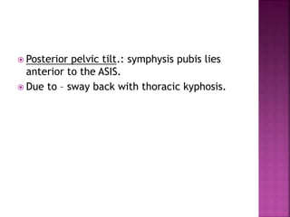  Posterior pelvic tilt.: symphysis pubis lies
anterior to the ASIS.
 Due to – sway back with thoracic kyphosis.
 