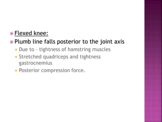  Flexed knee:
 Plumb line falls posterior to the joint axis
 Due to – tightness of hamstring muscles
 Stretched quadriceps and tightness
gastrocnemius
 Posterior compression force.
 