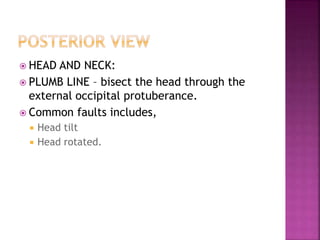  HEAD AND NECK:
 PLUMB LINE – bisect the head through the
external occipital protuberance.
 Common faults includes,
 Head tilt
 Head rotated.
 