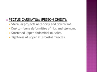  PECTUS CARINATUM (PIGEON CHEST):
 Sternum projects anteriorly and downward.
 Due to – bony deformities of ribs and sternum.
 Stretched upper abdominal muscles.
 Tightness of upper intercostal muscles.
 