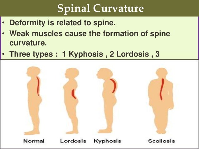 types of postures