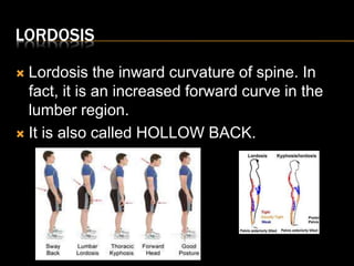 posture U-4 .pptx