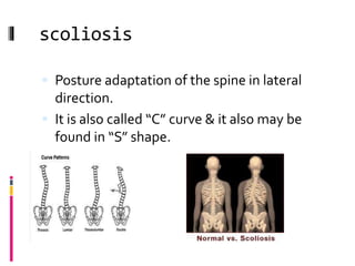 scoliosis
 Posture adaptation of the spine in lateral
direction.
 It is also called “C” curve & it also may be
found in “S” shape.
 