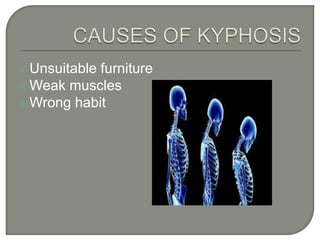 Unsuitable furniture
Weak muscles
Wrong habit
 