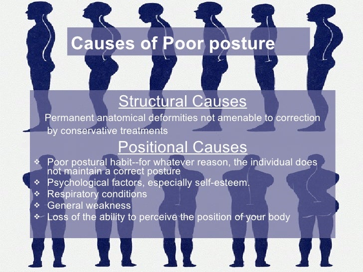 types of postures