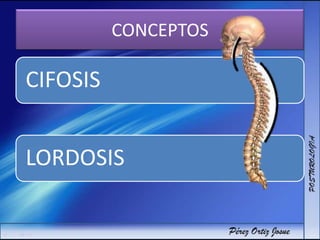 CONCEPTOS
CIFOSIS
LORDOSIS