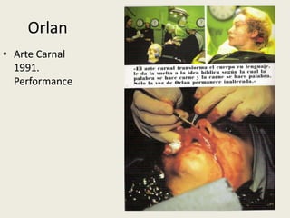 Orlan 
• Arte Carnal 
1991. 
Performance 
 