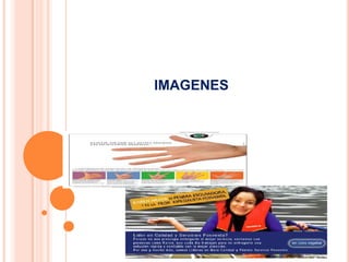imagenes