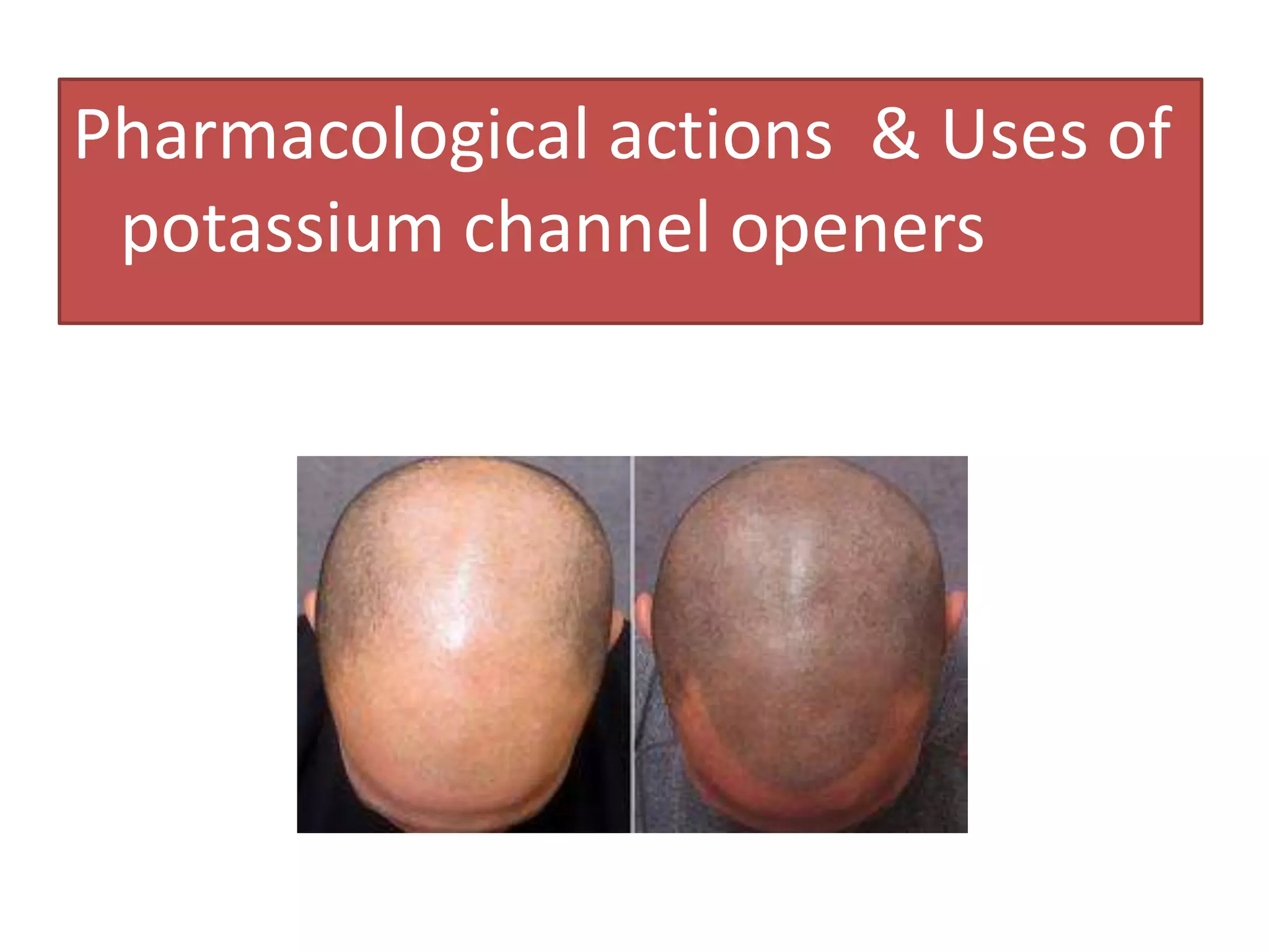 Pharmacological actions & Uses of
 potassium channel openers
 