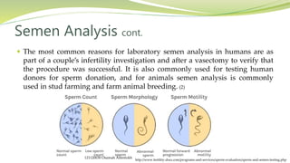  The most common reasons for laboratory semen analysis in humans are as
part of a couple’s infertility investigation and after a vasectomy to verify that
the procedure was successful. It is also commonly used for testing human
donors for sperm donation, and for animals semen analysis is commonly
used in stud farming and farm animal breeding. (2)
Semen Analysis cont.
http://www.fertility-docs.com/programs-and-services/sperm-evaluation/sperm-and-semen-testing.php
121120030 Osamah Alfentokh
 