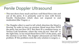  This test shows how much and how well blood flows into and
out of the penis. It is primarily used to men with Severe
Erectile Dysfunction which does not respond to oral
medication (like Viagra). (2)
 The Doppler effect is used to tell which direction the blood is
flowing. In order to have an erection, blood must flow INTO
the penis, but not flow OUT. But there IS a condition know as
Venous Leak Syndrome, where the veins do not “shut off” ar
the right time, so too much blood flows OUT of the penis, and
the erection is not firm. The doppler ultrasound can find this
problem. IF this problem exists the only solution is surgery. (2)
Penile Doppler Ultrasound
https://www.indiamart.com/saharyabr
others/gynecology-equipment.html121120030 Osamah Alfentokh
 