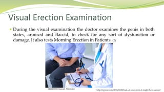  During the visual examination the doctor examines the penis in both
states, aroused and flaccid, to check for any sort of dysfunction or
damage. It also tests Morning Erection in Patients. (2)
Visual Erection Examination
http://nypost.com/2016/10/20/look-at-your-penis-it-might-have-cancer/
121120030 Osamah Alfentokh
 