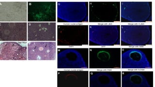 Potentals of human amniotic fluid stem cells | ODP
