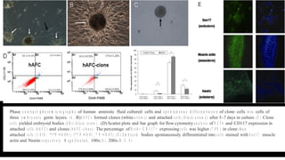 Potentals of human amniotic fluid stem cells | ODP