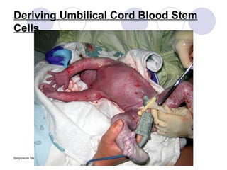 Deriving Umbilical Cord Blood Stem Cells 