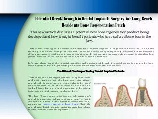 Potential Breakthrough in Dental Implants Surgery for Long Beach
Residents: Bone Regeneration Patch
This news article discusses a potential new bone regeneration product being
developed and how it might benefit patients who have suffered bone loss in the
jaw.
There’s a new technology on the horizon and it offers dental implant surgeons in Long Beach and across the United States
the ability to treat bone loss in patients without the need for invasive bone grafting surgery. Researchers at the University
of Iowa are currently working on a bone regeneration patch that contains the compounds necessary to stimulate bone
growth in areas of the jaw that have become atrophied as a result of tooth loss.
Let’s take a closer look at why this might constitute such a major breakthrough if this patch makes its way into the Long
Beach market and how it might benefit patients who have suffered from advanced bone loss.
Traditional Challenges Facing Dental Implant Patients
Traditionally, one of the biggest problems facing patients who
need dental implants, but who have been living without
natural teeth for many years or even decades is the loss of
bone volume from the jaw. This is caused by atrophication of
the hard tissue due to a lack of stimulation by the natural
tooth roots, which, of course, are no longer there.
“The loss of bone volume in the jaw not only causes one’s
natural facial contours to change and age prematurely, but it
also makes it difficult for the patient to receive new teeth,”
explains one cosmetic dentist in Long Beach. “Just like
natural teeth, dental implants require adequate bone volume
in order to remain stable and supported.”
 