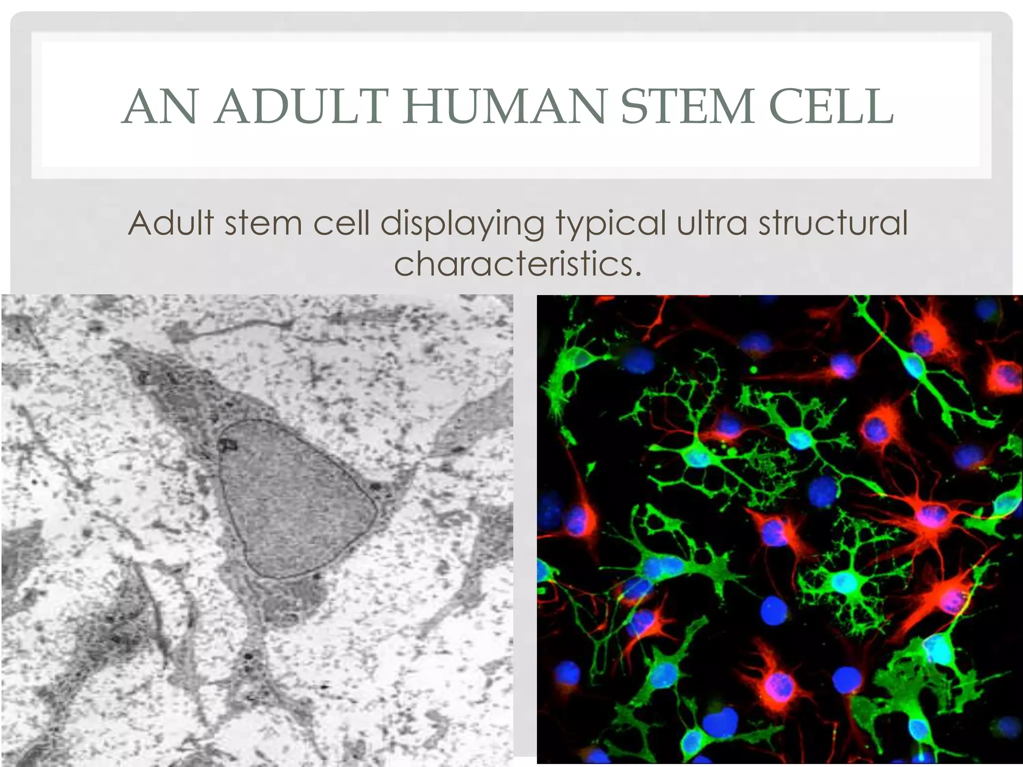 AN ADULT HUMAN STEM CELL
Adult stem cell displaying typical ultra structural
characteristics.
 