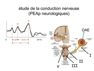 étude de la conduction nerveuse
(PEAp neurologiques)
0 10 ms
I
III
V
I-III III-V
I-V
I
II
IIIV
OAE
 