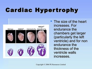 Copyright © 2006 PE Resources LimitedCopyright © 2006 PE Resources Limited
Cardiac HypertrophyCardiac Hypertrophy
 The size of the heartThe size of the heart
increases. Forincreases. For
endurance theendurance the
chambers get largerchambers get larger
(particularly the left(particularly the left
ventricle) and for nonventricle) and for non
endurance theendurance the
thickness of thethickness of the
ventricle wallsventricle walls
increases.increases.
 