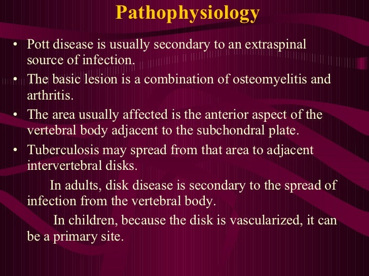 Pott Disease