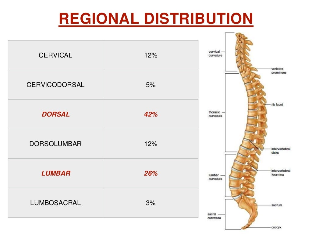 Pott's disease ppt