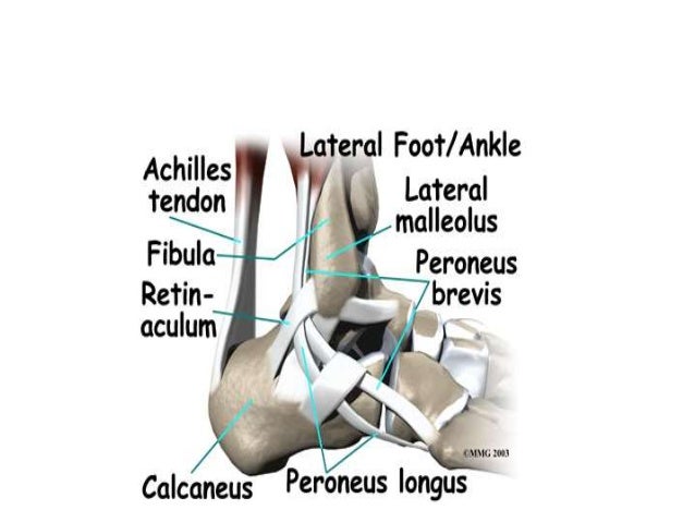 pott s fracture