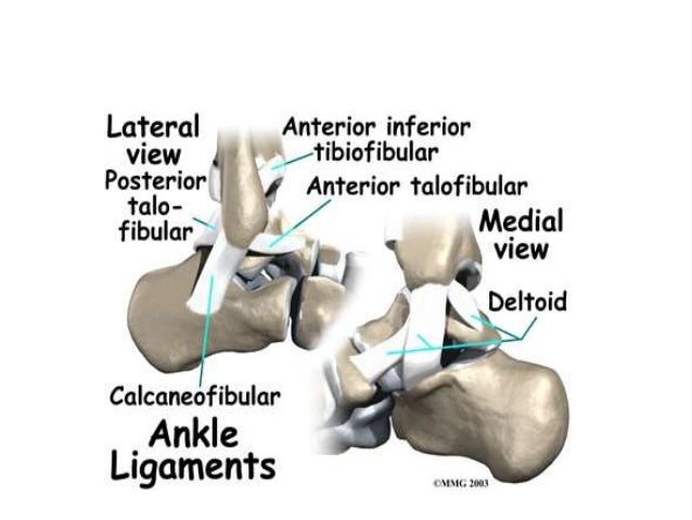 pott s fracture