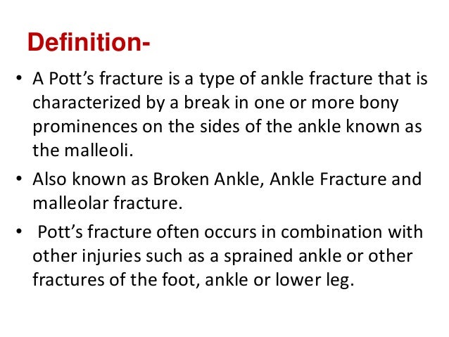 pott s fracture