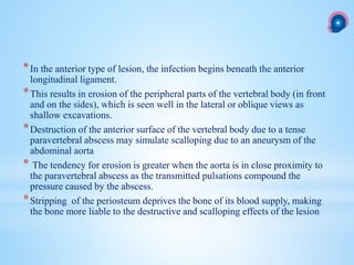 *In the anterior type of lesion, the infection begins beneath the anterior
longitudinal ligament.
*This results in erosion of the peripheral parts of the vertebral body (in front
and on the sides), which is seen well in the lateral or oblique views as
shallow excavations.
*Destruction of the anterior surface of the vertebral body due to a tense
paravertebral abscess may simulate scalloping due to an aneurysm of the
abdominal aorta
* The tendency for erosion is greater when the aorta is in close proximity to
the paravertebral abscess as the transmitted pulsations compound the
pressure caused by the abscess.
*Stripping of the periosteum deprives the bone of its blood supply, making
the bone more liable to the destructive and scalloping effects of the lesion
 