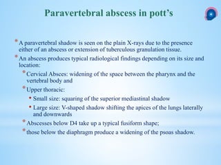 *A paravertebral shadow is seen on the plain X-rays due to the presence
either of an abscess or extension of tuberculous granulation tissue.
*An abscess produces typical radiological findings depending on its size and
location:
*Cervical Absces: widening of the space between the pharynx and the
vertebral body and
*Upper thoracic:
• Small size: squaring of the superior mediastinal shadow
• Large size: V-shaped shadow shifting the apices of the lungs laterally
and downwards
*Abscesses below D4 take up a typical fusiform shape;
*those below the diaphragm produce a widening of the psoas shadow.
Paravertebral abscess in pott’s
 