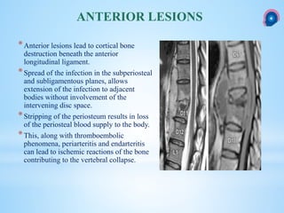 *Anterior lesions lead to cortical bone
destruction beneath the anterior
longitudinal ligament.
*Spread of the infection in the subperiosteal
and subligamentous planes, allows
extension of the infection to adjacent
bodies without involvement of the
intervening disc space.
*Stripping of the periosteum results in loss
of the periosteal blood supply to the body.
*This, along with thromboembolic
phenomena, periarteritis and endarteritis
can lead to ischemic reactions of the bone
contributing to the vertebral collapse.
ANTERIOR LESIONS
 