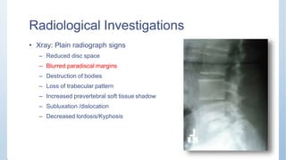 Radiological Investigations
• Xray: Plain radiograph signs
– Reduced disc space
– Blurred paradiscal margins
– Destruction of bodies
– Loss of trabecular pattern
– Increased prevertebral soft tissue shadow
– Subluxation /dislocation
– Decreased lordosis/Kyphosis
 