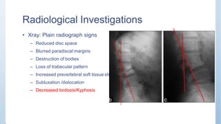 Radiological Investigations
adow
• Xray: Plain radiograph signs
– Reduced disc space
– Blurred paradiscal margins
– Destruction of bodies
– Loss of trabecular pattern
– Increased prevertebral soft tissue sh
– Subluxation /dislocation
– Decreased lordosis/Kyphosis
 