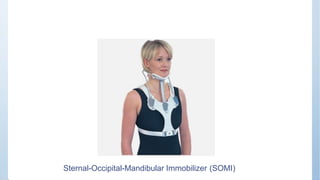 Sternal-Occipital-Mandibular Immobilizer (SOMI)
 