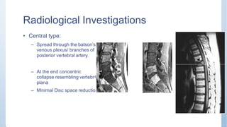 Radiological Investigations
• Central type:
– Spread through the batson’s
venous plexus/ branches of
posterior vertebral artery.
– At the end concentric
collapse resembling vertebr
plana
– Minimal Disc space reductio
a
n
 