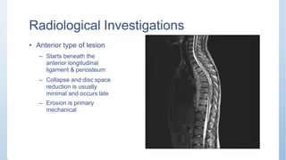Radiological Investigations
• Anterior type of lesion
– Starts beneath the
anterior longitudinal
ligament & periosteum
– Collapse and disc space
reduction is usually
minimal and occurs late
– Erosion is primary
mechanical
 