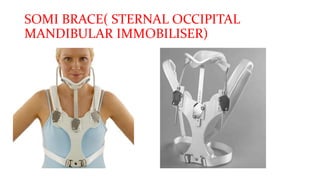 SOMI BRACE( STERNAL OCCIPITAL
MANDIBULAR IMMOBILISER)
•
 