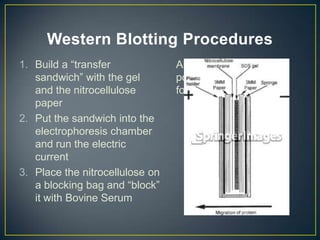 Western Blotting Procedures
1. Build a “transfer             Albumin with non fat
   sandwich” with the gel        powdered milk (liquid
   and the nitrocellulose        form)
   paper
2. Put the sandwich into the
   electrophoresis chamber
   and run the electric
   current
3. Place the nitrocellulose on
   a blocking bag and “block”
   it with Bovine Serum
 
