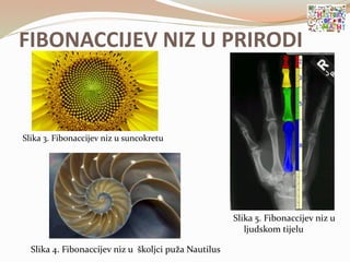 FIBONACCIJEV NIZ U PRIRODI
Slika 3. Fibonaccijev niz u suncokretu
Slika 4. Fibonaccijev niz u školjci puža Nautilus
Slika 5. Fibonaccijev niz u
ljudskom tijelu
 