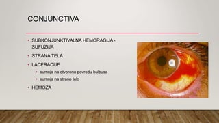 mehanicke Povrede oka i pomoc u lecenju | PPT