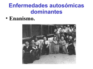Enfermedades autosómicas
dominantes
• Enanismo.
 