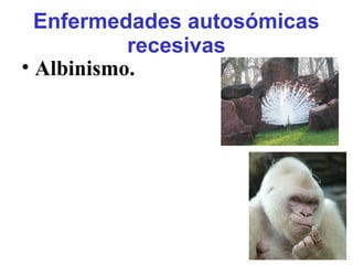 Enfermedades autosómicas
recesivas
• Albinismo.
 