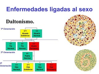 Enfermedades ligadas al sexo
Daltonismo.
 