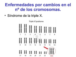 Enfermedades por cambios en el
nº de los cromosomas.
• Síndrome de la triple X.
 