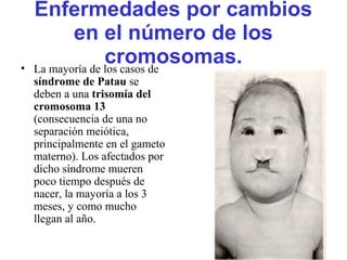 Enfermedades por cambios
en el número de los
cromosomas.• La mayoría de los casos de
síndrome de Patau se
deben a una trisomía del
cromosoma 13
(consecuencia de una no
separación meiótica,
principalmente en el gameto
materno). Los afectados por
dicho síndrome mueren
poco tiempo después de
nacer, la mayoría a los 3
meses, y como mucho
llegan al año.
 