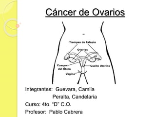 Cáncer de Ovarios
Integrantes: Guevara, Camila
Peralta, Candelaria
Curso: 4to. “D” C.O.
Profesor: Pablo Cabrera
 