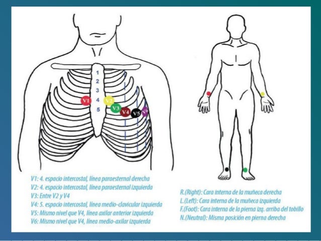 Power Electrocardiograma